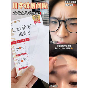 瞿颖同款!川字纹贴眉间眉头皱纹贴睡觉专用法令纹贴提拉消除神器