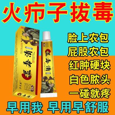 闷头火疖子坐板疮肿硬块