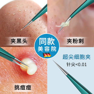 德国细胞夹黑头超细粉刺夹超尖黑头夹镊子刮去闭口美容院专用工具