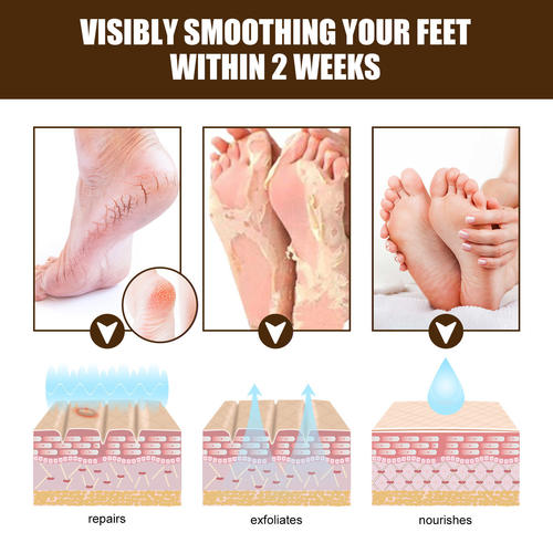 Herbal Anti Cra Foot Cream  Anti-Drying Cra Feet Cream