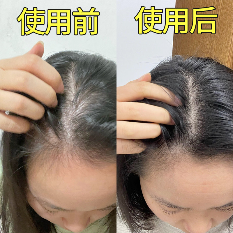 坚持洗 12天包长】头发快速增长 自然增发变浓密 防脱固发 买2发3