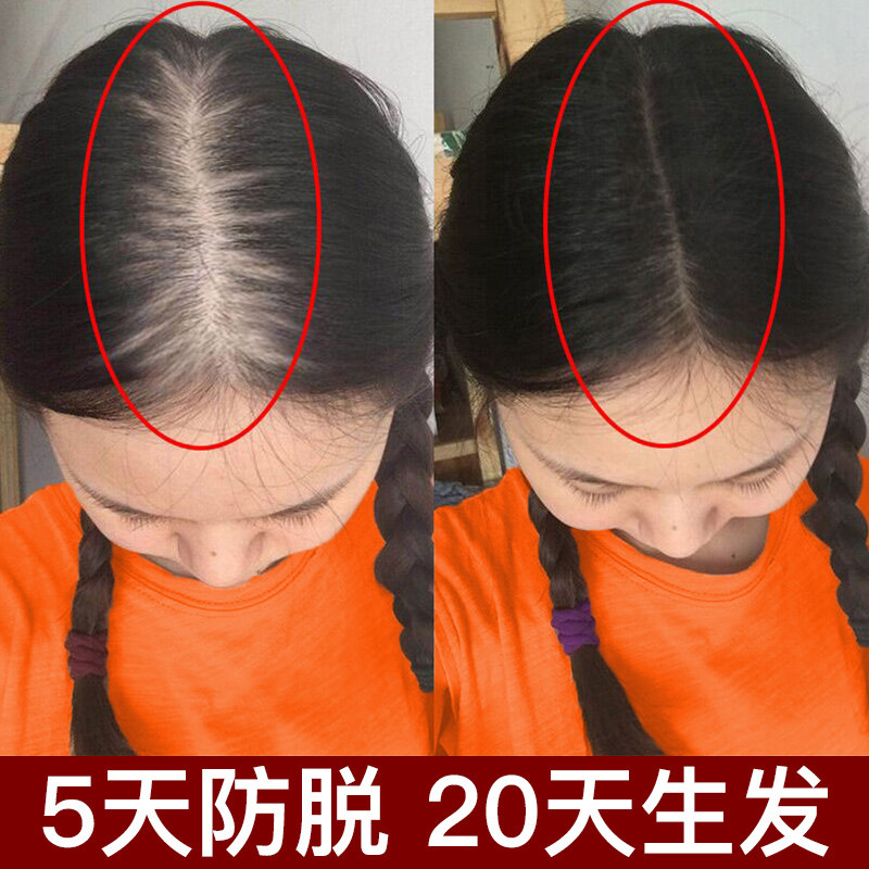 10天止脱 20天生发 洗出浓密发量 育发选对发量翻倍 不做秃头2发3