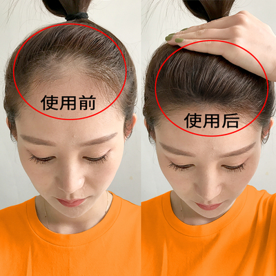 小红书爆款13天自然生长】轻松洗出浓密秀发告别植发专业固发2发3