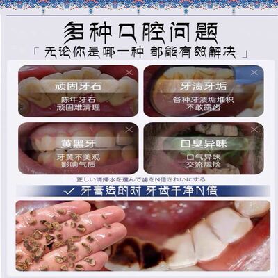 【小红书推荐】牙石溶解牙膏美白去黄烟渍牙垢牙结石口气清新正品