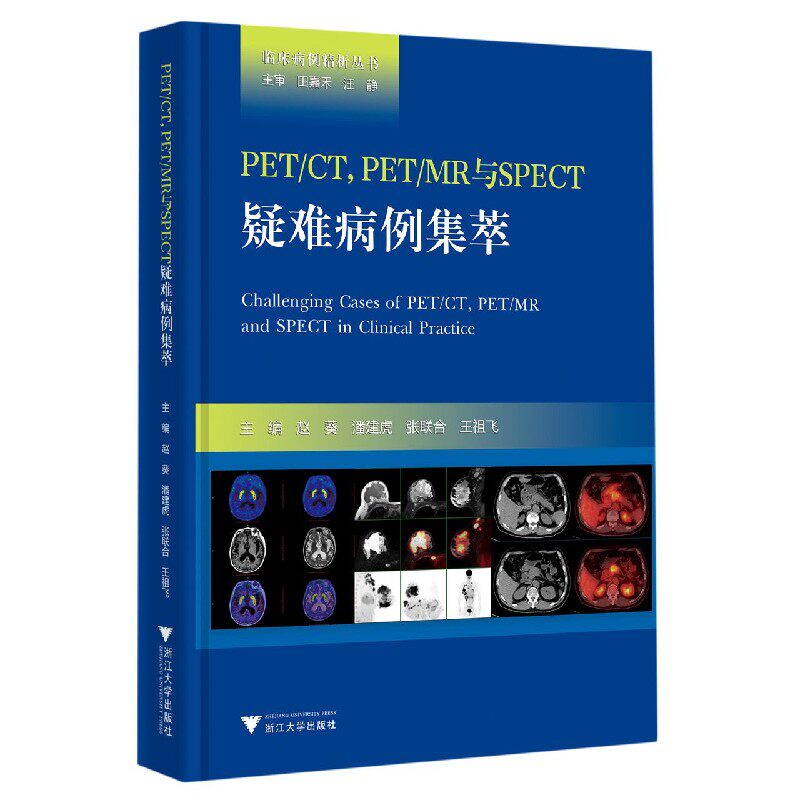 PET\CT PET\MR与SPECT疑难病例集萃(精)