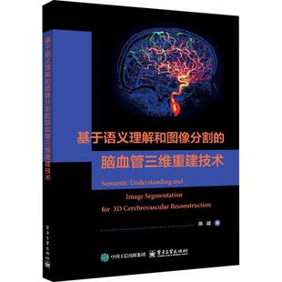 基于语义理解和图像分割 脑血管三维重建技术