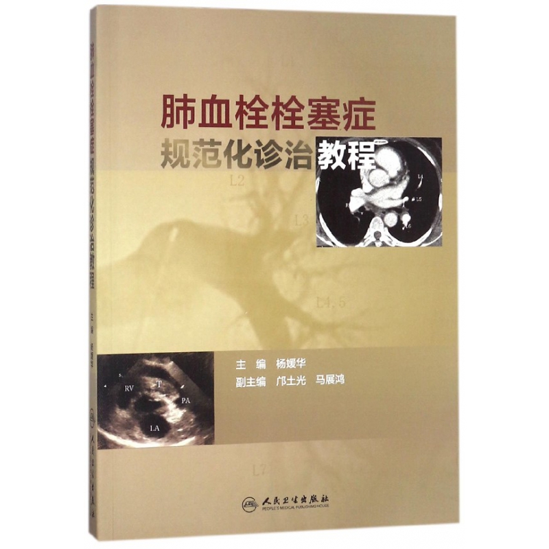 肺血栓栓塞症规范化诊治教程