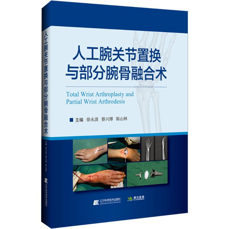 人工腕关节置换与部分腕骨融合术