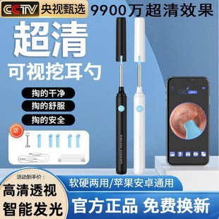 高清可视掏耳勺掏耳神器儿童成人专业可视采耳发光带灯智能挖耳勺
