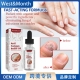 灰指甲修护液 West Month 凹凸厚甲脱甲软甲亮甲滋润修护液
