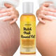 Removal Stretch Mark Oil产后紧致护理油淡化身体纹油身体按摩油