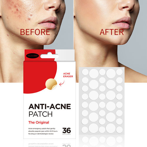 外贸英文ANTI-ACNE PATCH痘痘贴36粒痤疮贴水胶体透明隐形痘痘贴