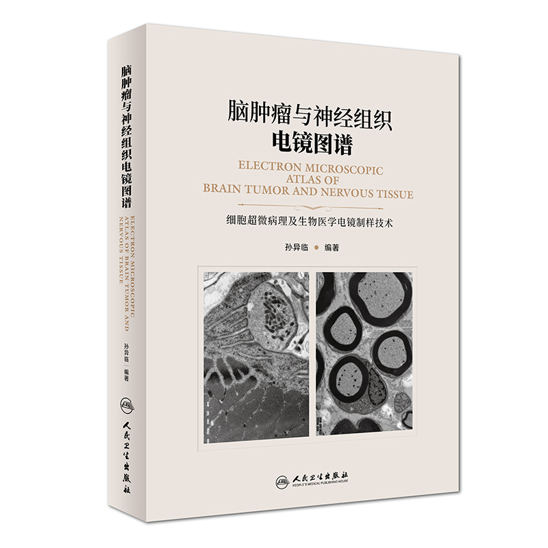 脑肿瘤与神经组织电镜图谱 孙异临 编著 内科学 9787117269025 参考书 人民卫生出版社