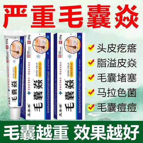 头皮毛囊炎头部头痒有红疙瘩专用长痘痘去手臂后背马拉色菌乳膏