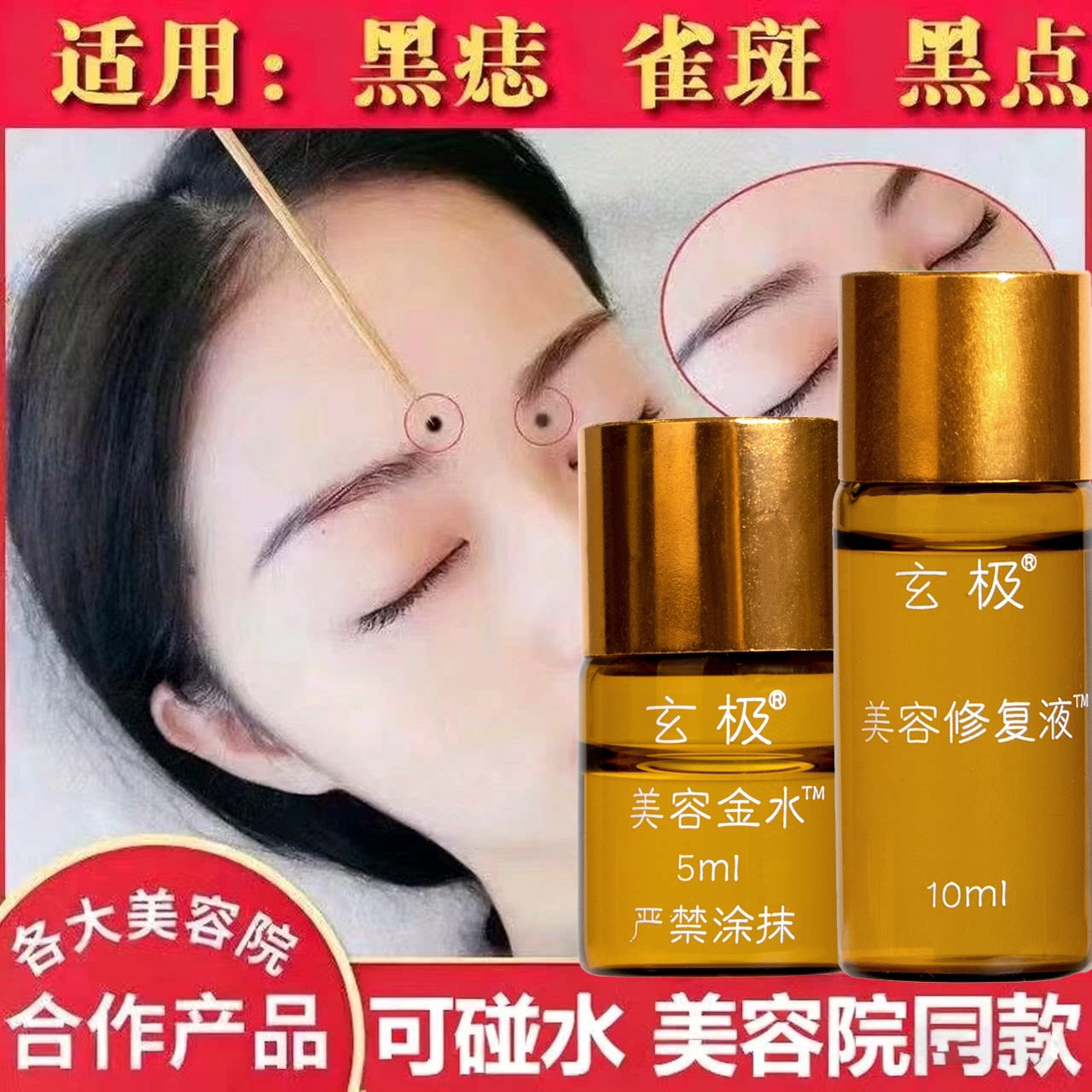 正品无痕点痣膏脸部祛痣淡斑