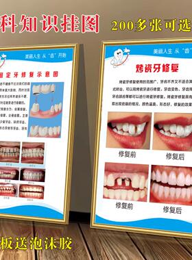 牙科挂图知识宣传画口腔诊所烤瓷牙解剖图海报规章制度KT板定制