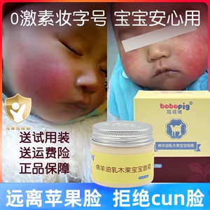 波波猪婴儿童宝宝面霜滋润保湿补水秋冬防皴皲裂润肤擦红苹果脸油