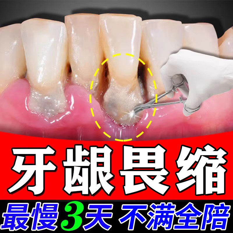 【自营】ASTACURE口腔脱敏牙膏牙齿抗敏感牙科分离剂官方旗舰店