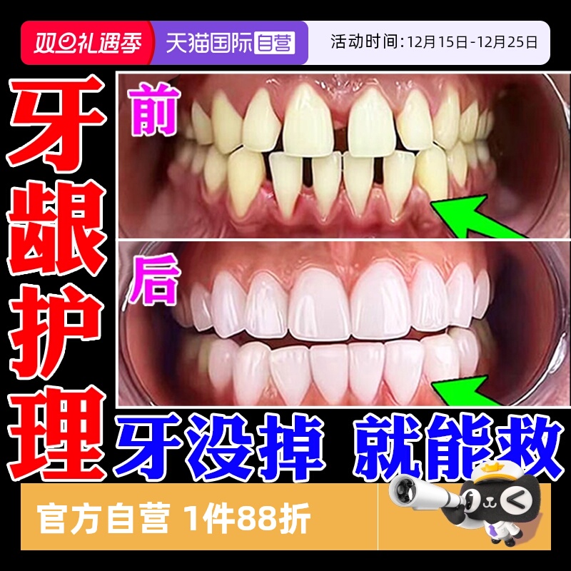 【自营】牙膏牙周口腔牙龈牙科分离剂修官方旗萎缩炎舰复店再治生