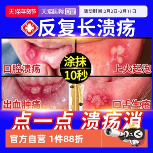 【自营】口腔溃疡专用特效膏贴西瓜霜喷剂药舌头溃疡散口疮凝胶