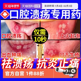 【自营】口腔溃疡专用特效膏贴西瓜霜喷剂药舌头溃疡散口疮凝胶