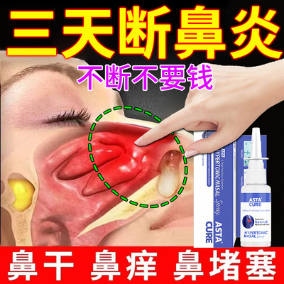 【自营】慢性鼻炎专用特效药膏儿童喷雾剂软膏断根官方正品鼻窦炎