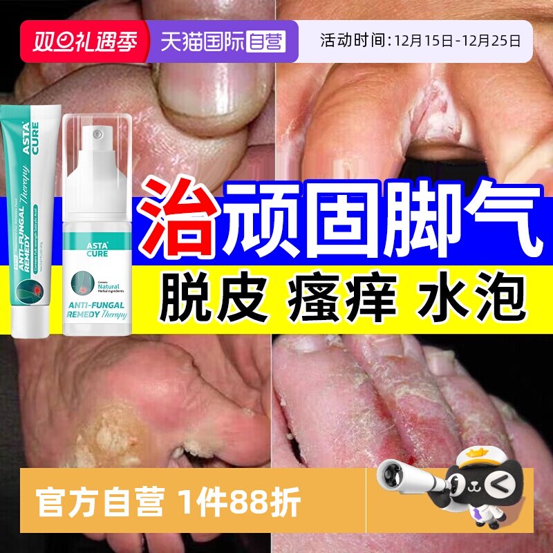 【自营】脚气止痒脱皮杀菌去根专用特效药脚痒水泡烂脚丫喷雾真菌