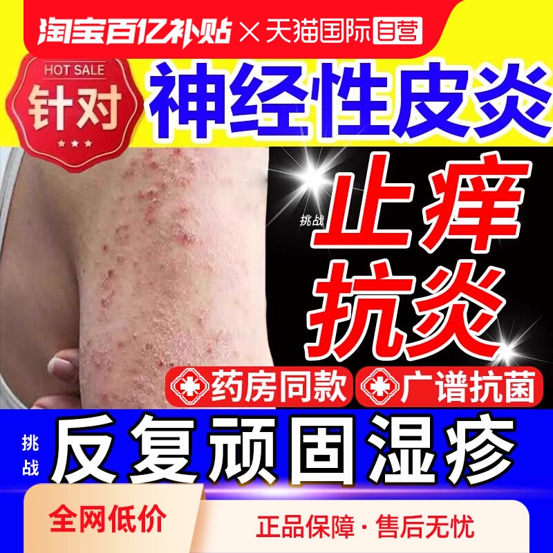 【自营】湿疹膏根湿疹止痒去外用顽固皮炎神经性汗疱疹除湿止痒膏