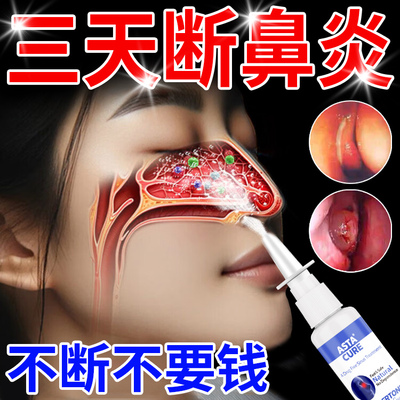 【自营】鼻炎喷雾剂专用特效药儿童慢性鼻窦炎药软膏断根官方正品