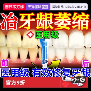 脱敏牙膏治牙周炎口腔牙龈萎缩修复再生专用正品官方旗舰