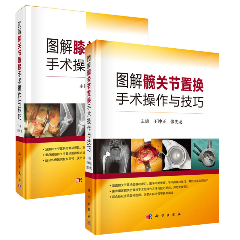 正版包邮 全2册图解髋关节置换手术操作与技巧+图解膝关节置换手术操作与技巧 髋关节置换基础理论书骨科医师关节外科临床骨科手术