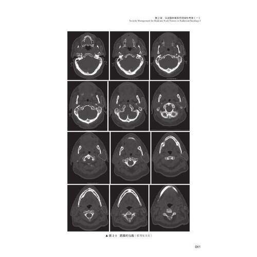 正版放射学急与晚期毒的:放射学中的毒管理:management of toxicities in radiation oncology书店医药卫生书籍 畅想畅销书