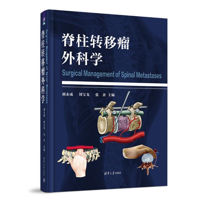 正版 脊柱转移瘤外科学 胡永成 刘宝戈 张余 脊柱前路重建 转移瘤评估手术方式选择手术重建方式诊疗 清华大学出版社9787302641360
