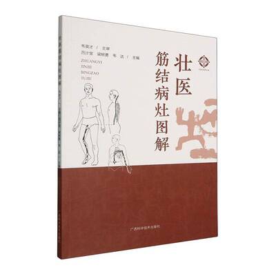壮医筋结病灶图解韦英才图书书籍