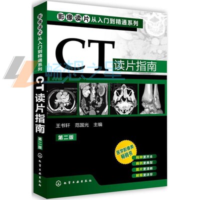 正版 CT读片指南（第二版）影像读片从入门到精通系列 医学影像类畅销书 影像诊断新手学习经验 医技学 影像学 X线 CT MRI读片指南