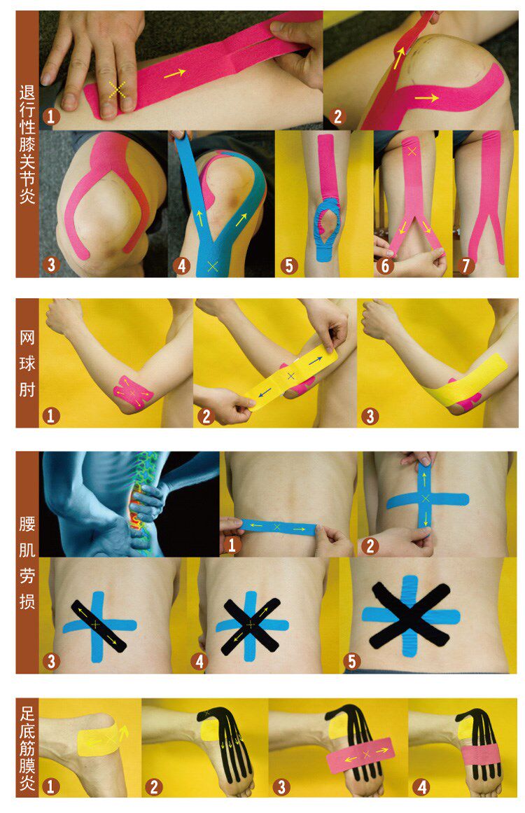 Protection sport - Ref 583770 Image 5