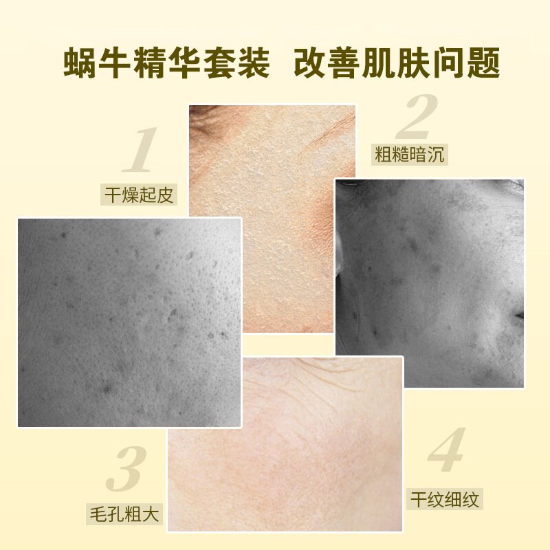 优妆蜗牛原液精华护肤品套装正品水乳补水霜保湿乳bb霜化妆品批发
