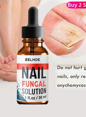 Foot Finger Liquid Anti Fungal Repair Serum Nail Removal Gel