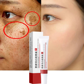 Dark Whitening Spo Remove Melasma Freckle Cream