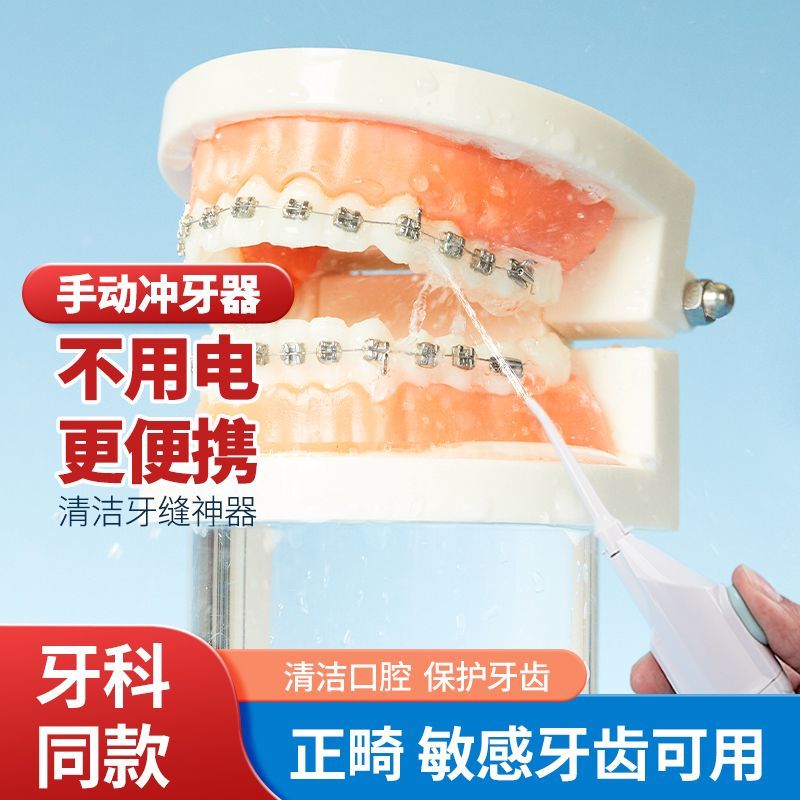便携手动冲牙器家用气压洗牙器智齿口腔牙齿正畸冲洗器儿童水牙线