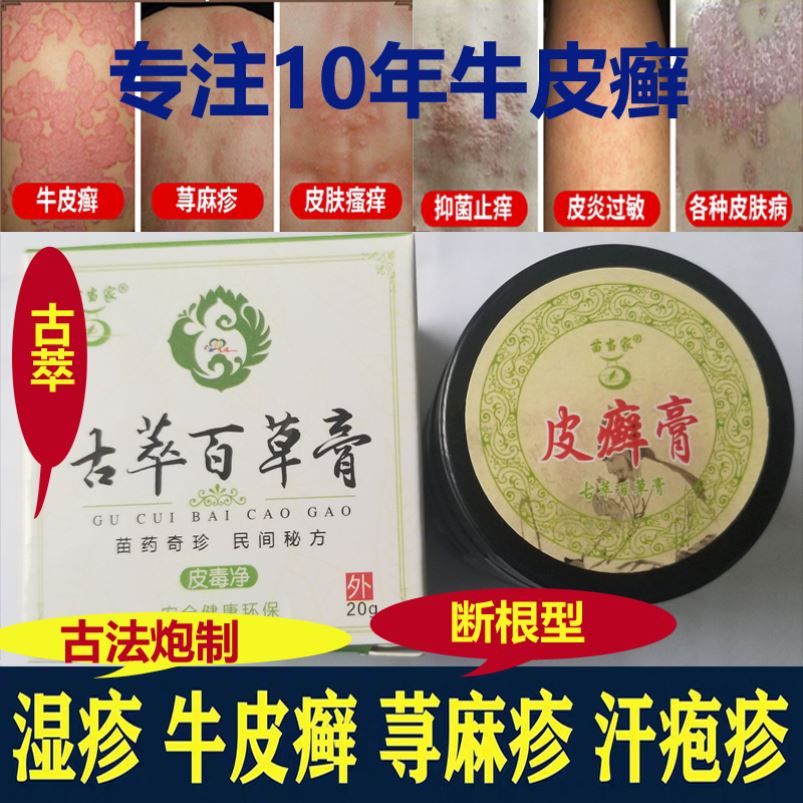 荨麻疹过敏止痒断根非银屑颗粒正品银屑治疗牛皮藓银屑药全身-封面