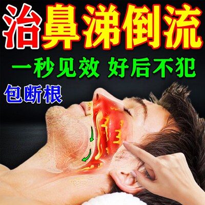 鼻涕倒流药鼻后滴漏综合症鼻甲肥大修复鼻腔黏膜药剂