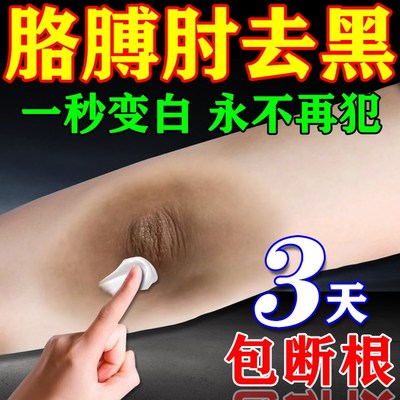 去黑色素沉淀胳膊肘黑去除死皮脸部全身皮肤黑磨砂膏药膏变白神器