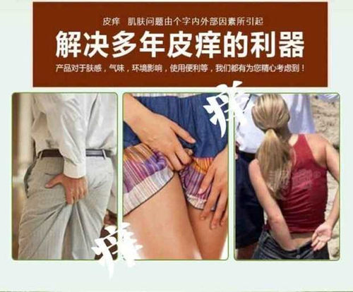 阴囊潮湿皮肤摩擦发红男女