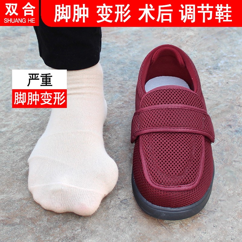 脚肿特殊脚型老人鞋女脚趾变形拇外翻加宽加肥妈妈鞋宽头春夏网鞋