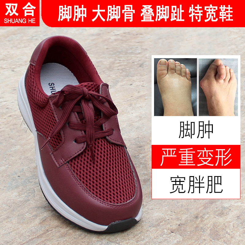 脚肿专用鞋加宽加肥老人宽松鞋女