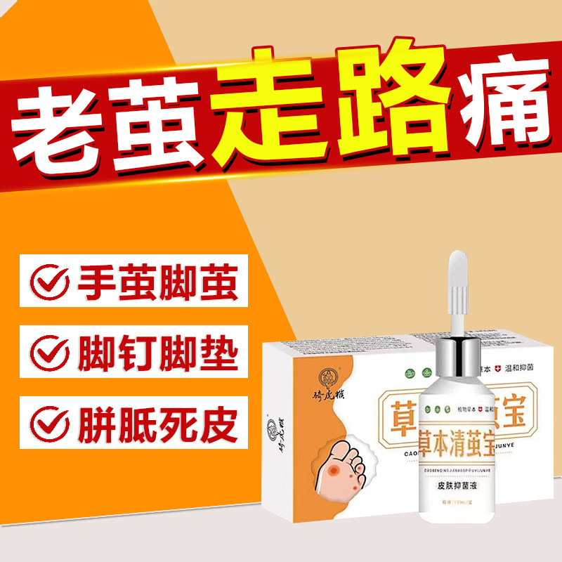 老茧去除软化剂祛手上茧子根神器去脚底硬死皮厚茧胼胝脚钉脚垫膏