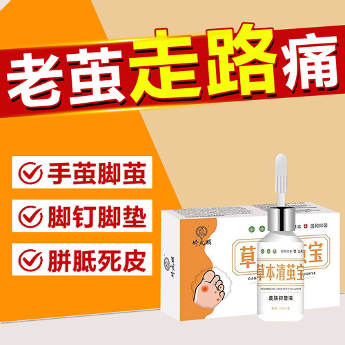老茧去除软化剂祛手上茧子根神器去脚底硬死皮厚茧胼胝脚钉脚垫膏