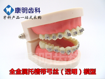 牙科牙齿正畸模型口腔金属陶瓷托槽模型门诊医患沟通展示牙模