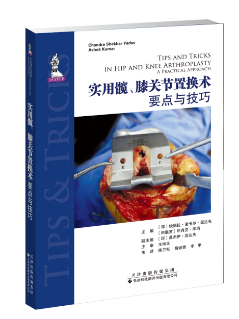 官方直营 实用髋、膝关节置换术：要点与技巧 髋、膝关节置换的基本概念 髋关节和膝关节的应用解剖学 全髋关节置换术的影像学评估